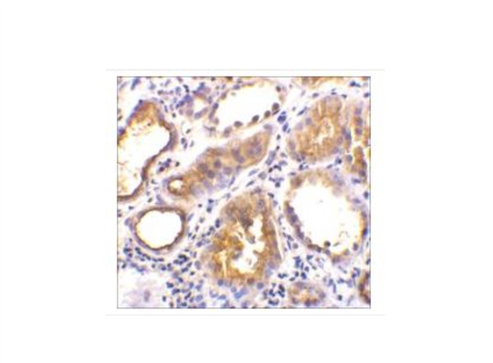 Picture of Anti-ACE2 antibody produced in rabbit